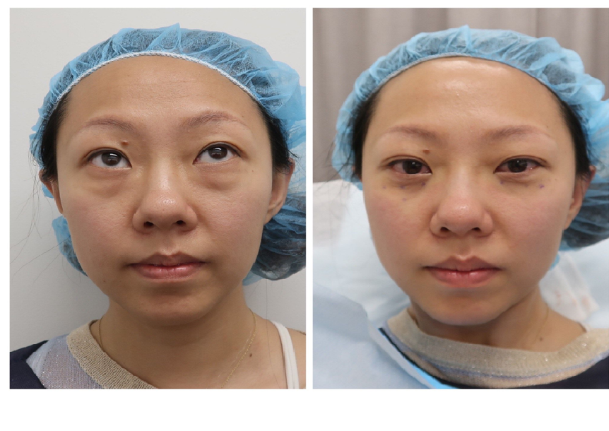 Different Procedures Designed To Make You Feel Confident